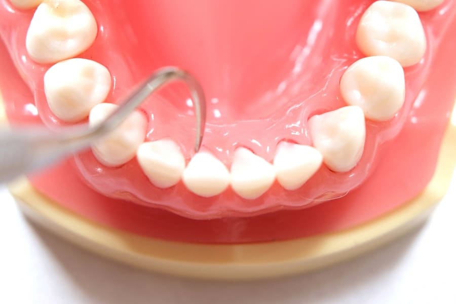 安全性の確保 現代歯科医学に基づいた医療機器でリスクを最小限に