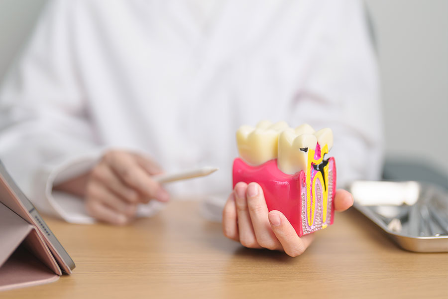 歯を残すことの価値