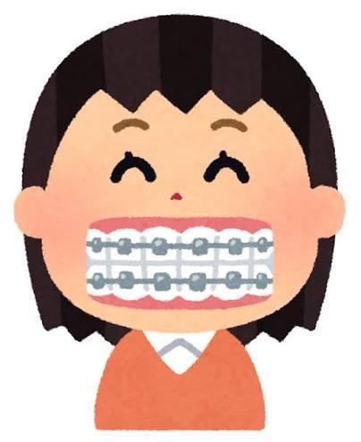 矯正をしている女の子