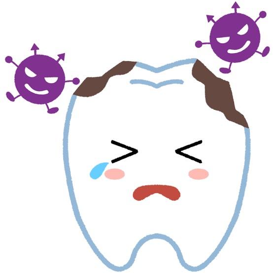 虫歯になった歯