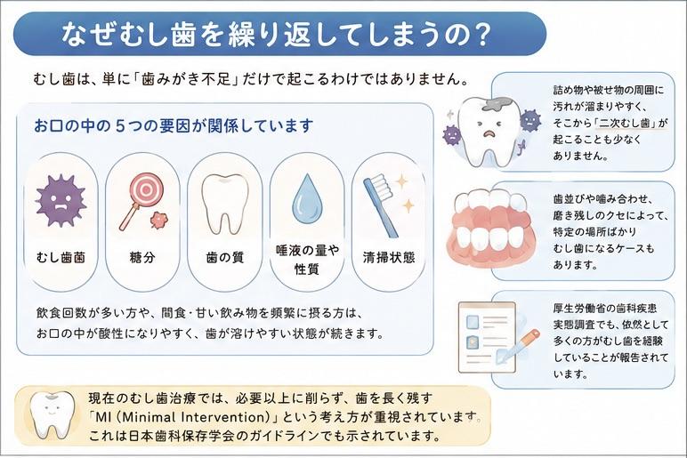 虫歯を繰り返す理由