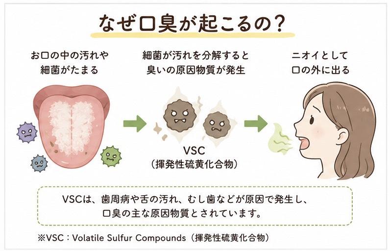 なぜ口臭が起こるの？