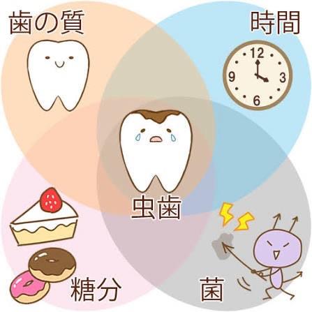 虫歯になる要因